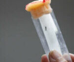 le-premier-vaccin-contre-le-chikungunya-approuve-aux-etats-unis