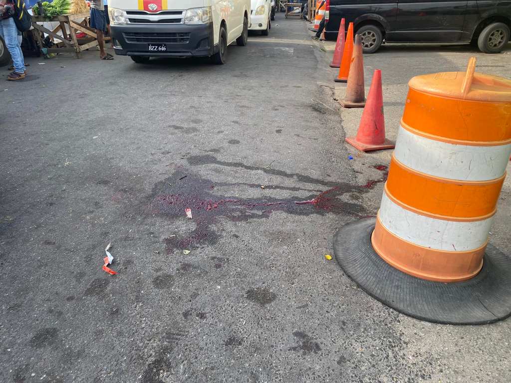 UPDATE: Taxi driver was shot in face, Police looking for two suspects
