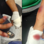 Couple. toddler injured during altercation at traffic stop 