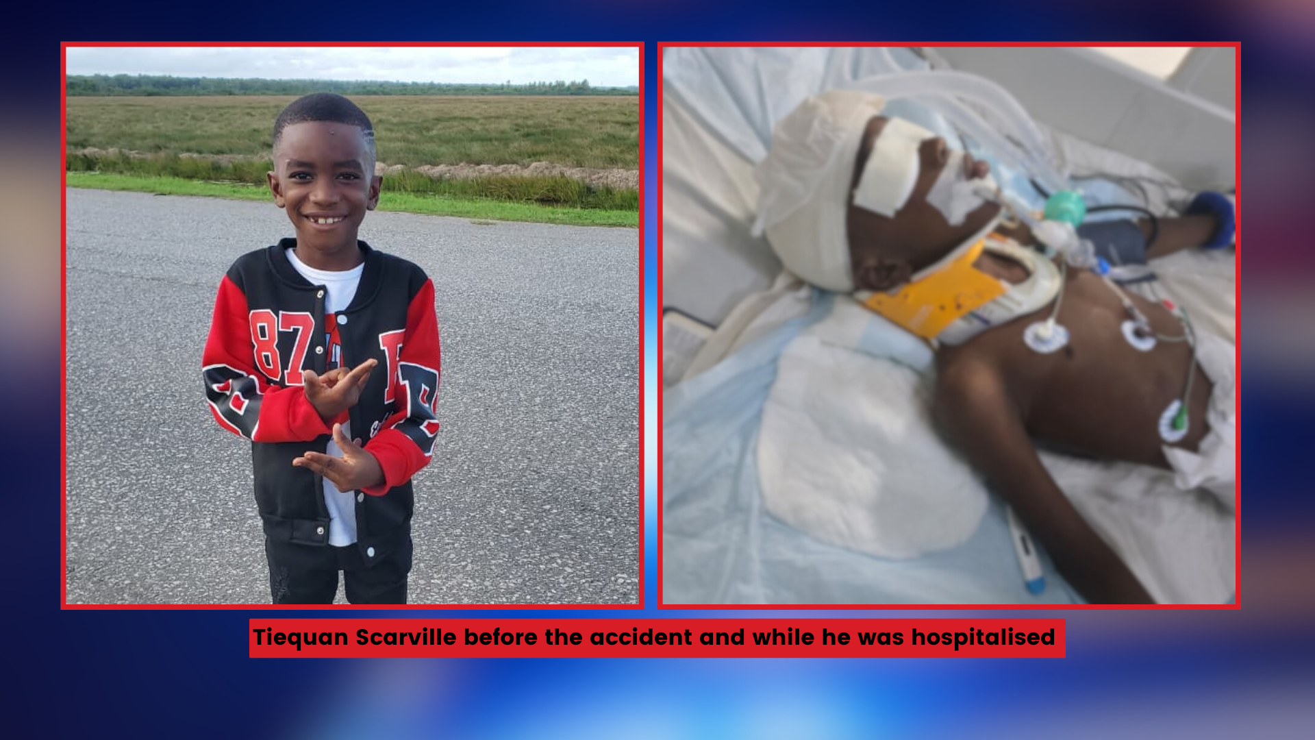 Mother hopes for full recovery of son, 7, after struck by canter