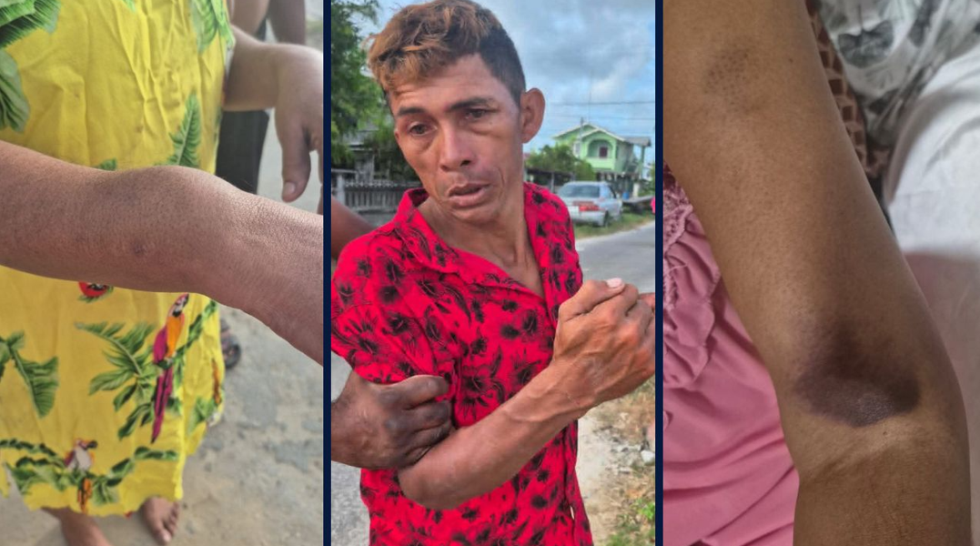 Elderly couple beaten by Spanish-speaking intruder at Lusignan home
