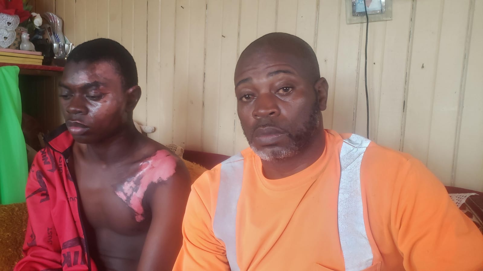 Father seeks answers after son burned at Port Mourant Apprentices hostel